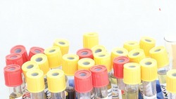 Генетическое обследование перед ЭКО станет бесплатным на Ставрополье 