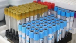 Запас сывороток от укусов змей и клещей сформировали на Ставрополье